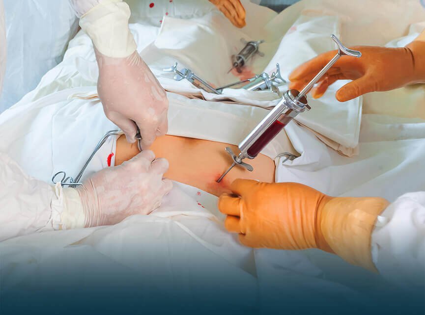 Bone Marrow  Transplant in India